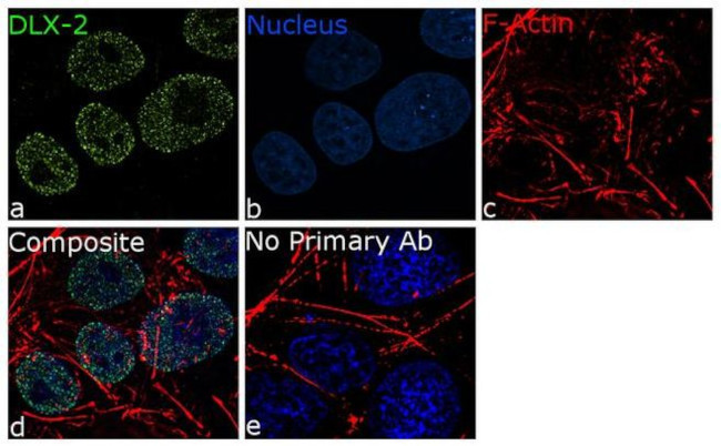 DLX2 Antibody in Immunocytochemistry (ICC/IF)