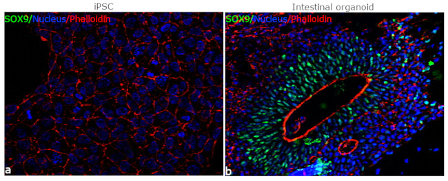 SOX9 Antibody in Immunocytochemistry (ICC/IF)