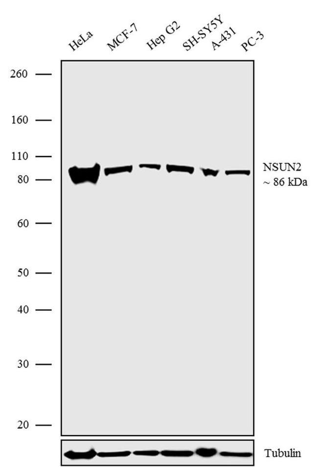 NSUN2 Antibody in Western Blot (WB)