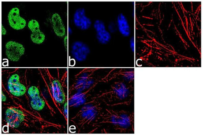 NSUN2 Antibody in Immunocytochemistry (ICC/IF)