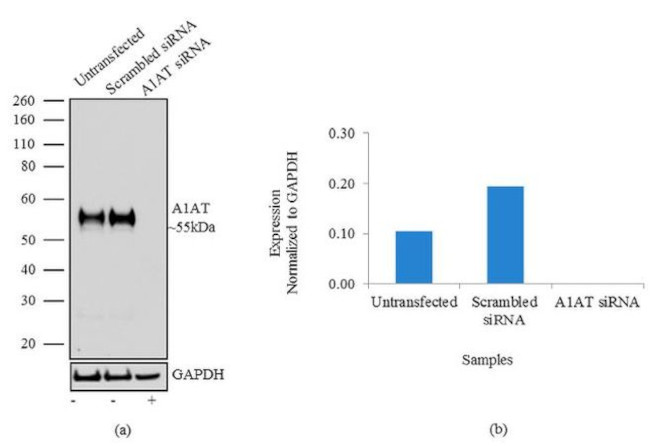 alpha-1 Antitrypsin Antibody