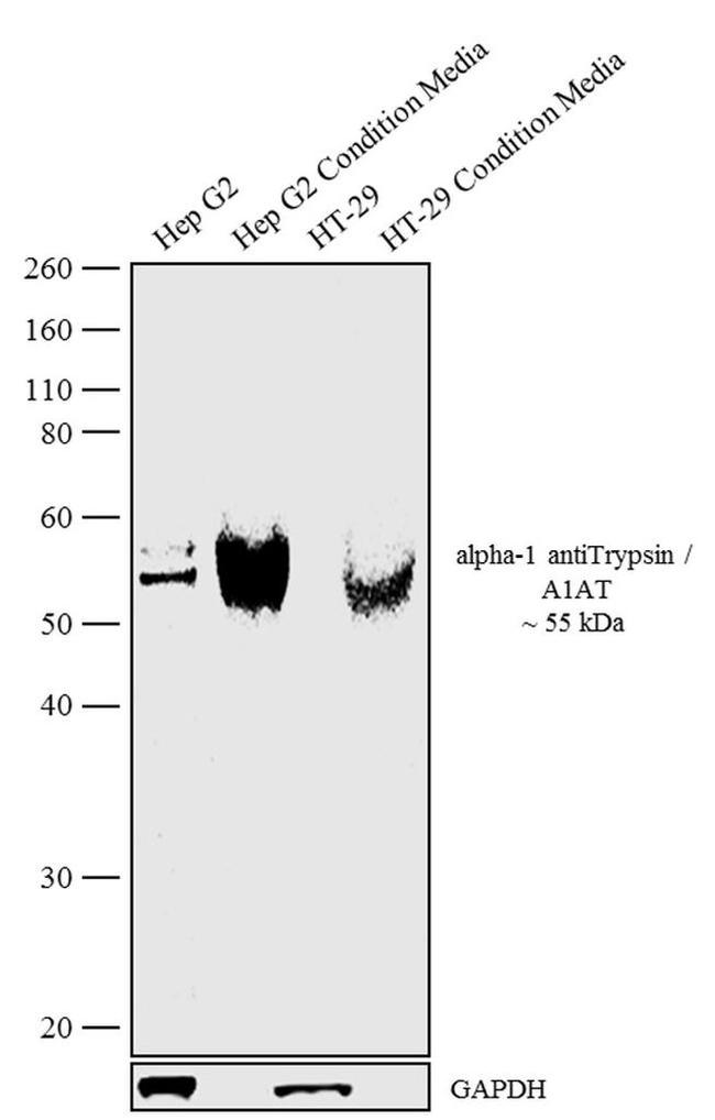 alpha-1 Antitrypsin Antibody in Western Blot (WB)