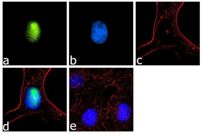 TERT Antibody in Immunocytochemistry (ICC/IF)