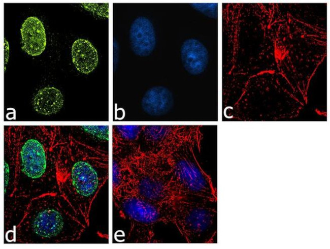 TBX3 Antibody in Immunocytochemistry (ICC/IF)