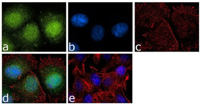 Annexin A1 Antibody in Immunocytochemistry (ICC/IF)