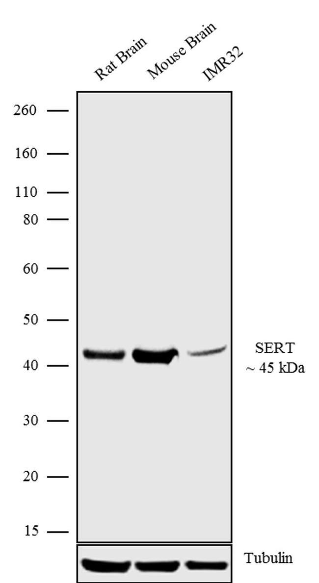 SLC6A4 Antibody in Western Blot (WB)