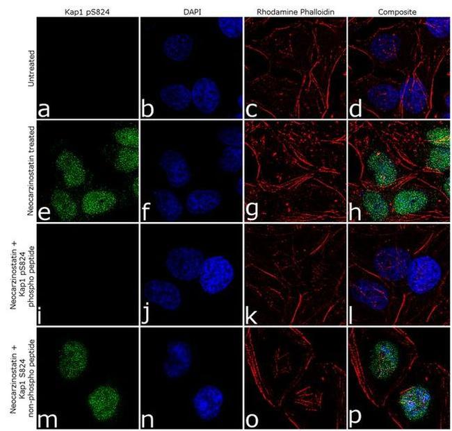 Phospho-TRIM28 (Ser824) Antibody