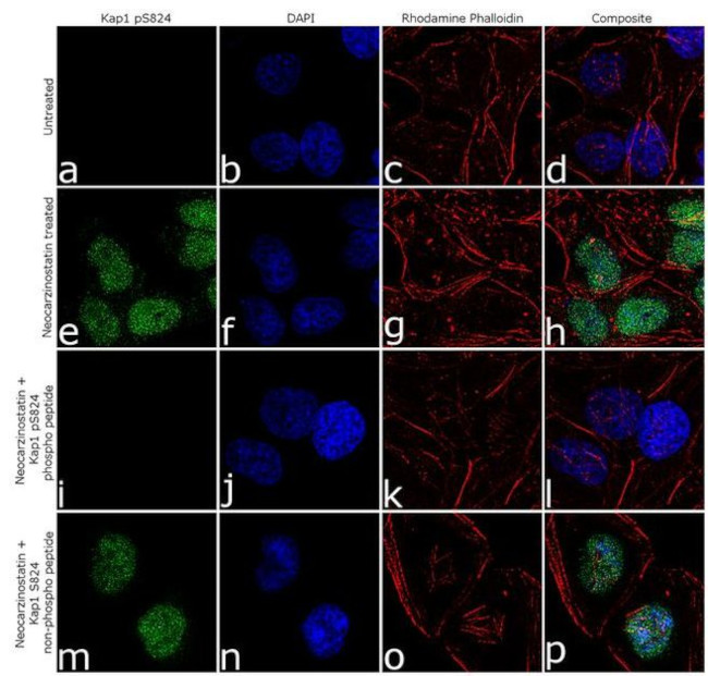 Phospho-TRIM28 (Ser824) Antibody in Immunocytochemistry (ICC/IF)