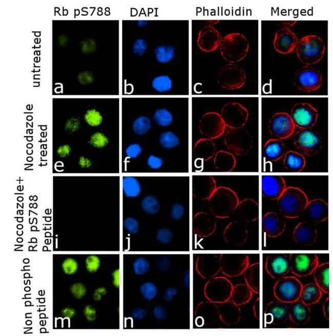 Phospho-Rb (Ser788) Antibody