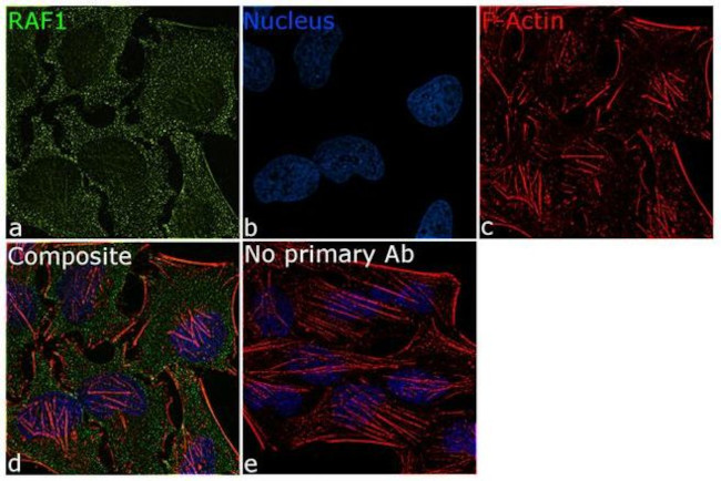 c-Raf Antibody in Immunocytochemistry (ICC/IF)