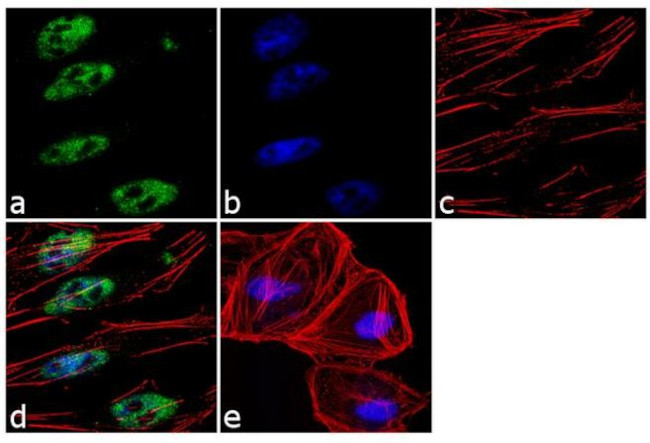 c-Jun Antibody in Immunocytochemistry (ICC/IF)