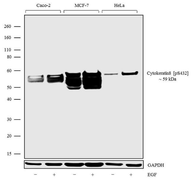 Phospho-Cytokeratin 8 (Ser432) Antibody