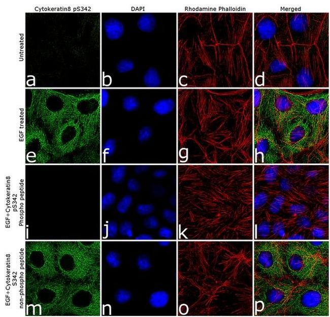 Phospho-Cytokeratin 8 (Ser432) Antibody