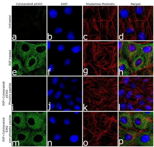 Phospho-Cytokeratin 8 (Ser432) Antibody in Immunocytochemistry (ICC/IF)