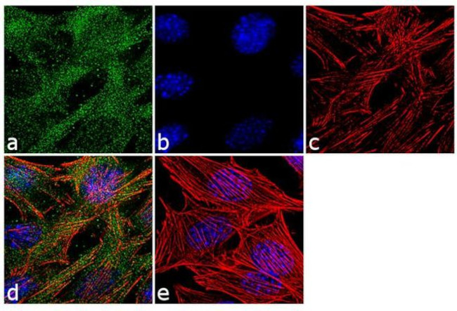 Laminin-211 Antibody in Immunocytochemistry (ICC/IF)