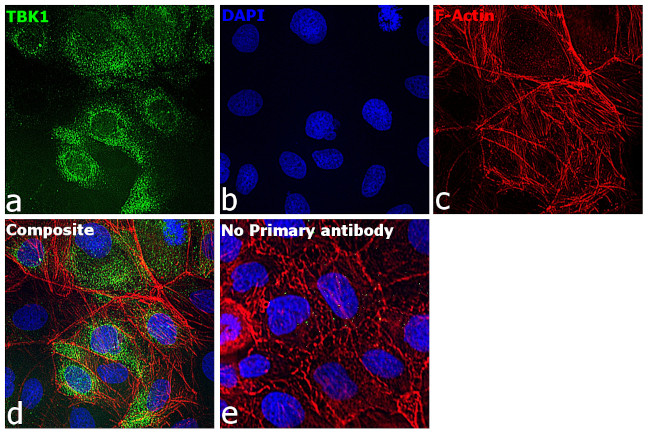 TBK1 Antibody in Immunocytochemistry (ICC/IF)