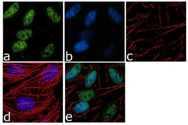 SMURF2 Antibody in Immunocytochemistry (ICC/IF)