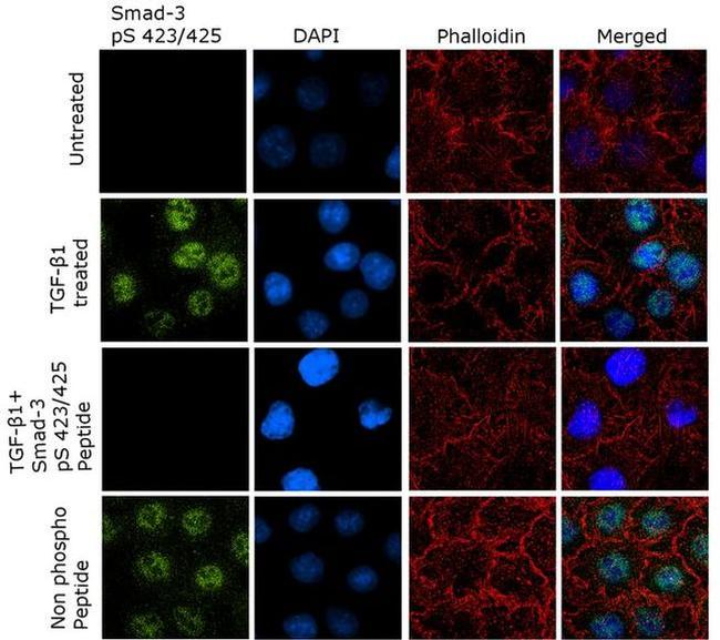 Phospho-SMAD3 (Ser423, Ser425) Antibody