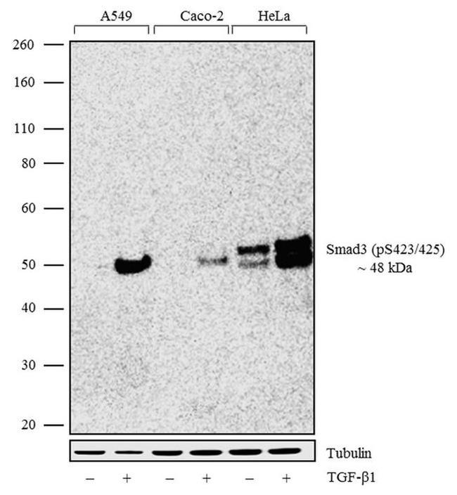 Phospho-SMAD3 (Ser423, Ser425) Antibody in Western Blot (WB)