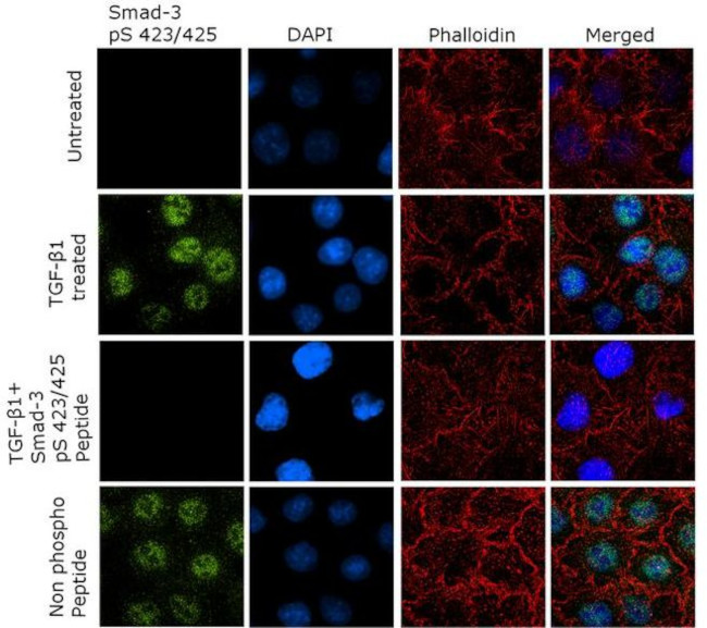 Phospho-SMAD3 (Ser423, Ser425) Antibody in Immunocytochemistry (ICC/IF)