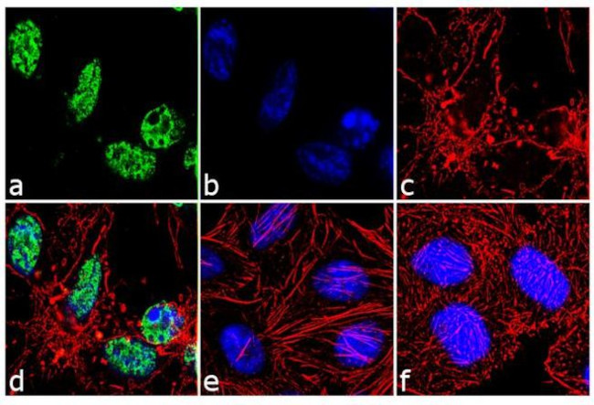 PARP1 Antibody in Immunocytochemistry (ICC/IF)