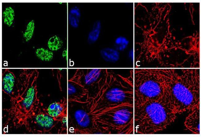 PARP1 Antibody