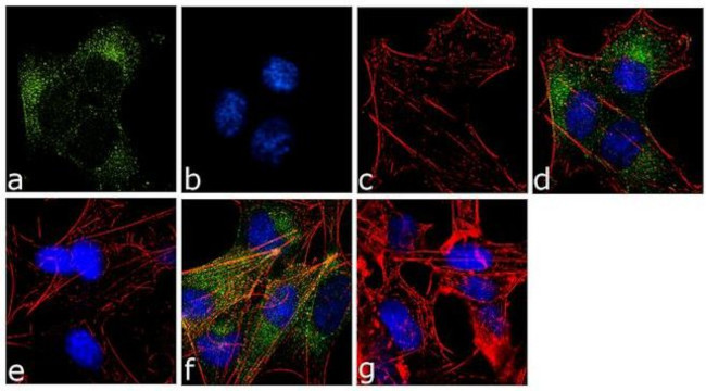 Phospho-CaMKII (Thr305,Thr306) Antibody in Immunocytochemistry (ICC/IF)