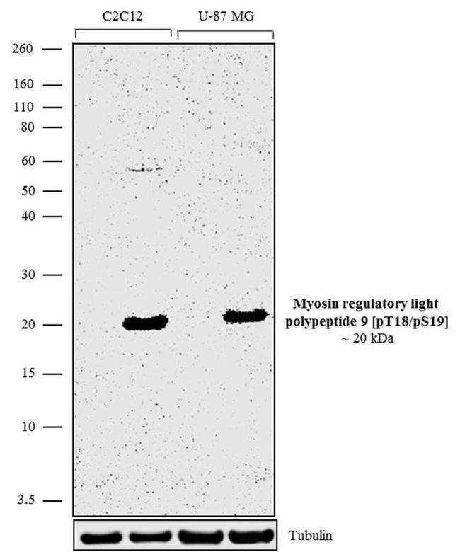 Phospho-MYL9 (Thr18, Ser19) Antibody in Western Blot (WB)