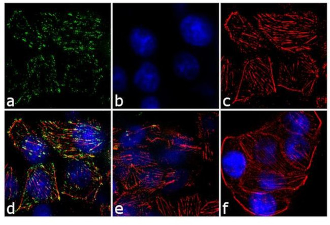 JAK2 Antibody in Immunocytochemistry (ICC/IF)