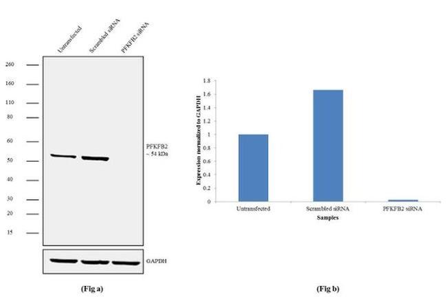 PFKFB2 Antibody in Western Blot (WB)