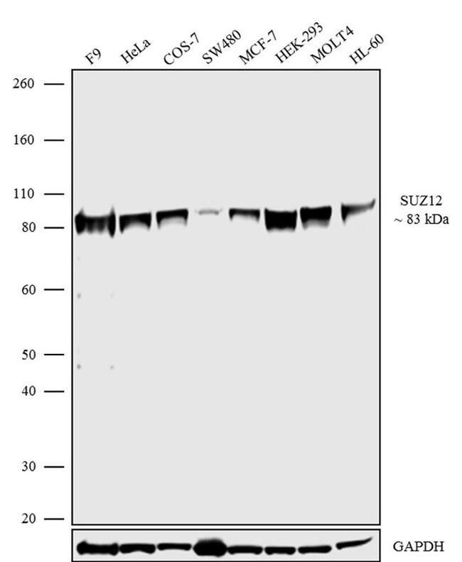 SUZ12 Antibody in Western Blot (WB)