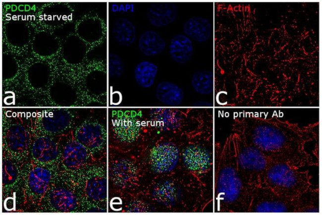 PDCD4 Antibody in Immunocytochemistry (ICC/IF)