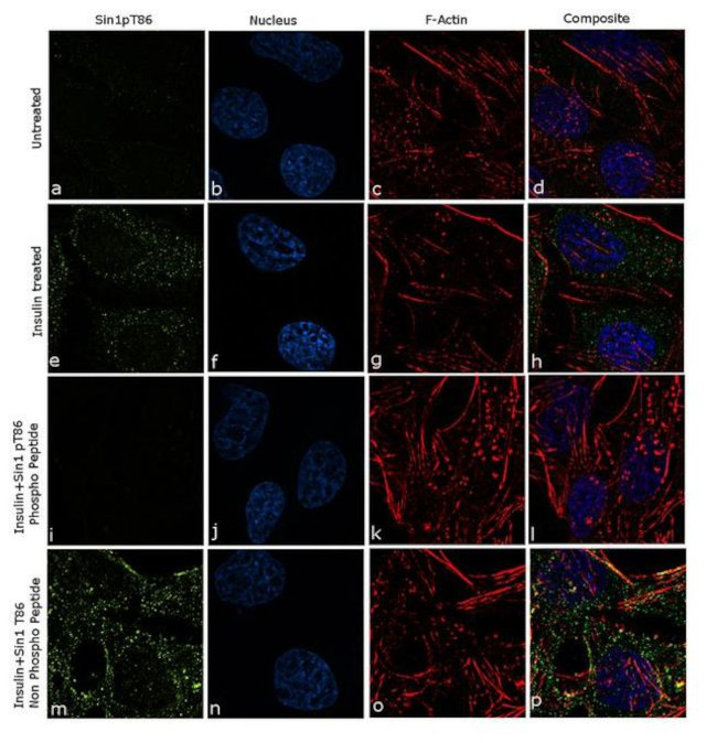 Phospho-MAPKAP1 (Thr86) Antibody in Immunocytochemistry (ICC/IF)