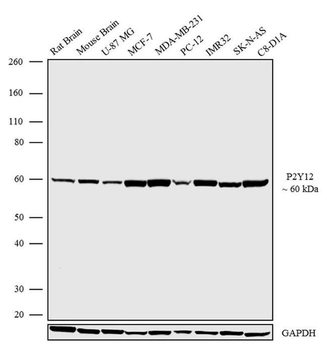 P2Y12 Antibody in Western Blot (WB)