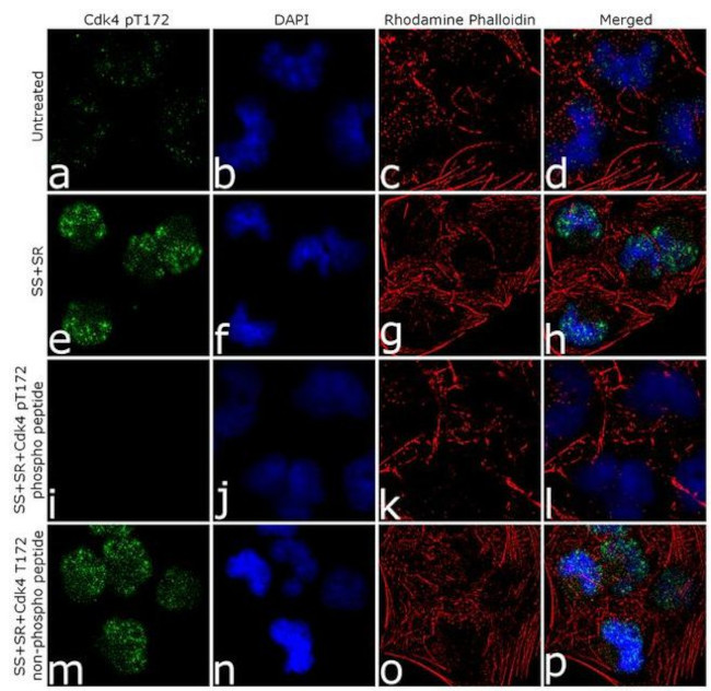 Phospho-CDK4 (Thr172) Antibody in Immunocytochemistry (ICC/IF)