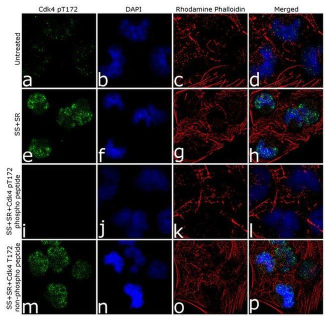 Phospho-CDK4 (Thr172) Antibody