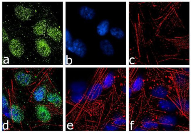 Neurogenin 2 Antibody in Immunocytochemistry (ICC/IF)