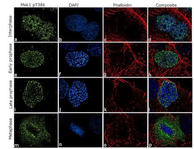 Phospho-MEK1 (Thr386) Antibody in Immunocytochemistry (ICC/IF)