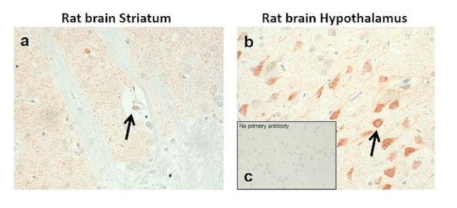 DRD1 Antibody in Immunohistochemistry (IHC)