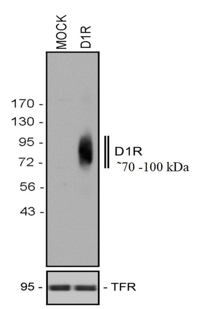 DRD1 Antibody in Western Blot (WB)