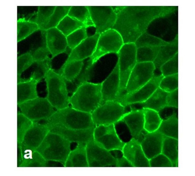 CRHR1 Antibody in Immunocytochemistry (ICC/IF)