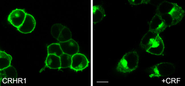 CRHR1 Antibody in Immunocytochemistry (ICC/IF)