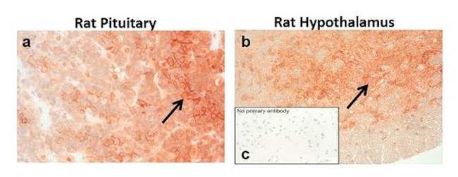 CRHR1 Antibody in Immunohistochemistry (IHC)