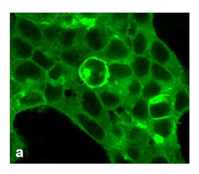 MCHR1 Antibody in Immunocytochemistry (ICC/IF)