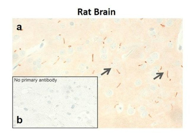 MCHR1 Antibody in Immunohistochemistry (IHC)