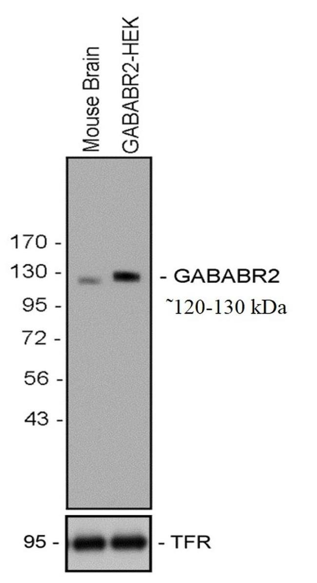 GABBR2 Antibody in Western Blot (WB)