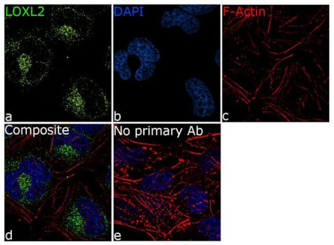 LOXL2 Antibody in Immunocytochemistry (ICC/IF)