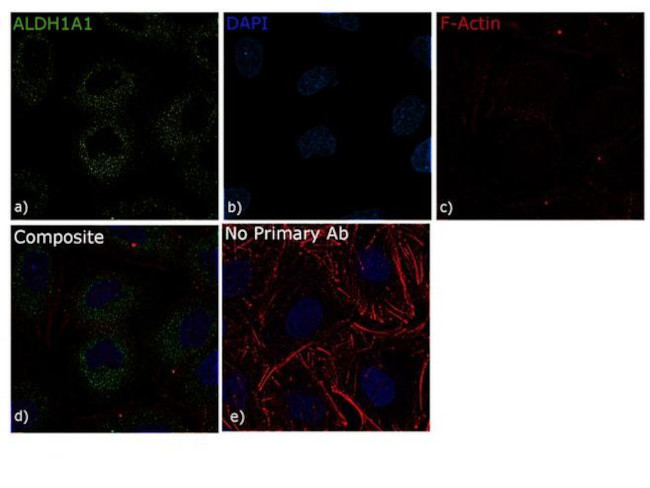 ALDH1A1 Antibody in Immunocytochemistry (ICC/IF)