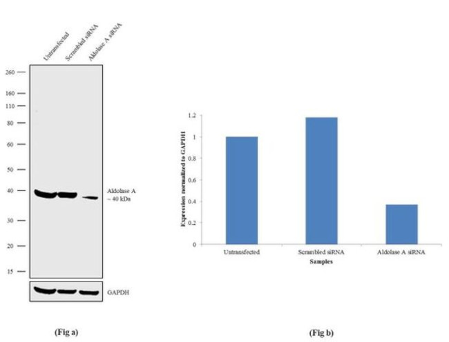 Aldolase A Antibody