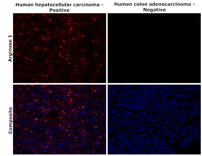 Arginase 1 Antibody in Immunohistochemistry (Paraffin) (IHC (P))